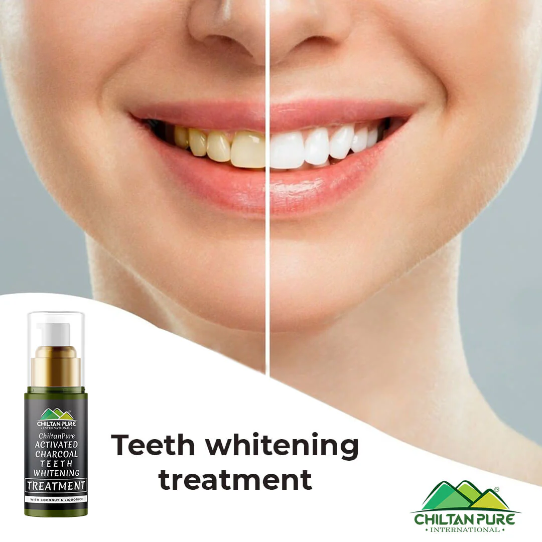 Activated Charcoal Teeth 🦷 Whitening Treatment - Whitens Teeth Naturally, Kills Cavity causing Bacteria Eliminates Bad Breath - Image 18