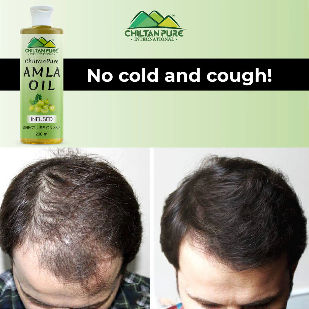 Amla Oil – Lessen Hair Loss, Boosts Hair Growth, Treats Dry Scalp & Prevents Premature Hair Greying - Image 7