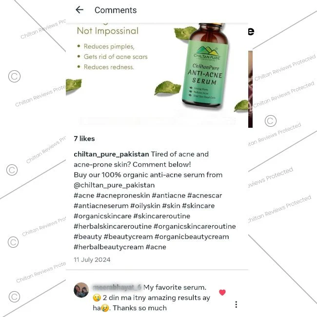 Anti – Acne Serum – Brightens Skin, Fades Acne, Lighten Acne Scars & Control Excess Oil Production - Image 5