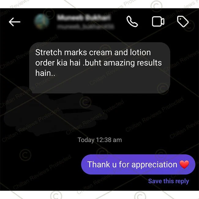Anti-Stretch Marks Cream – Formulated With Shea Butter, Coco Butter & Vitamin E, Prevent Scars & Stretch Marks With Intense Hydration & Smoothing - Image 5