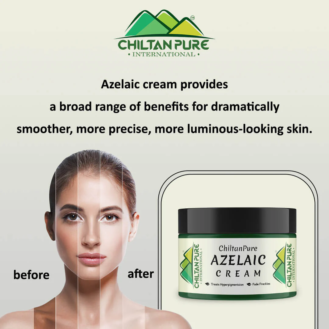Azelaic Acid Cream / Azelaic Cream – Antibacterial, Lighten Freckles, Reduce Hyperpigmentation & Fade Acne Scars - Image 3
