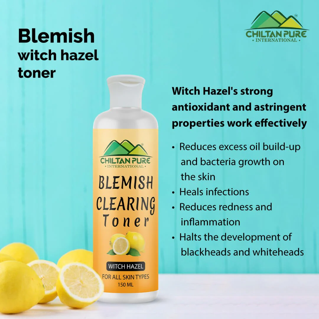 Blemish Clearing Toner – Soothes Redness & Inflammation, Fights with Acne & Helps Prevent Breakouts, Good For All Skin Types 150ml - Image 2