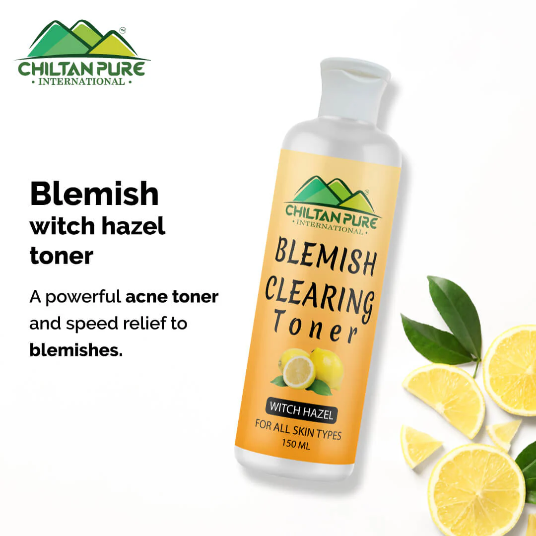 Blemish Clearing Toner – Soothes Redness & Inflammation, Fights with Acne & Helps Prevent Breakouts, Good For All Skin Types 150ml - Image 3