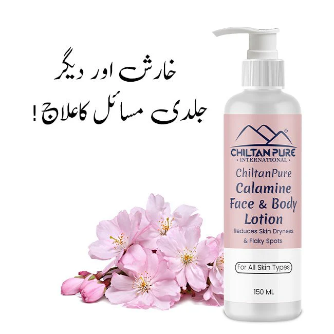 Calamine Lotion – Solution to every allergy, contains anti-allergic properties, Reduces skin dryness – 100% organic 150ml