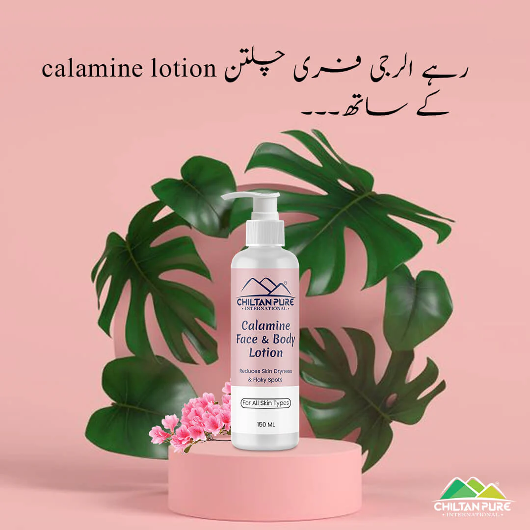 Calamine Lotion – Solution to every allergy, contains anti-allergic properties, Reduces skin dryness – 100% organic 150ml - Image 3