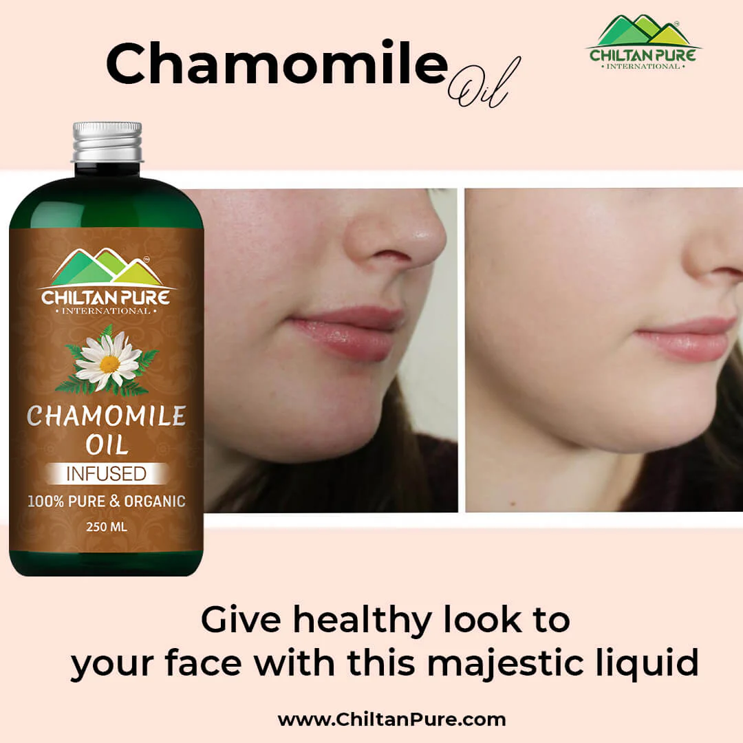 Chamomile Oil – Give Healthy Look to Your Face & Hair With This Majestic Liquid [بابونہ] 200ml - Image 2