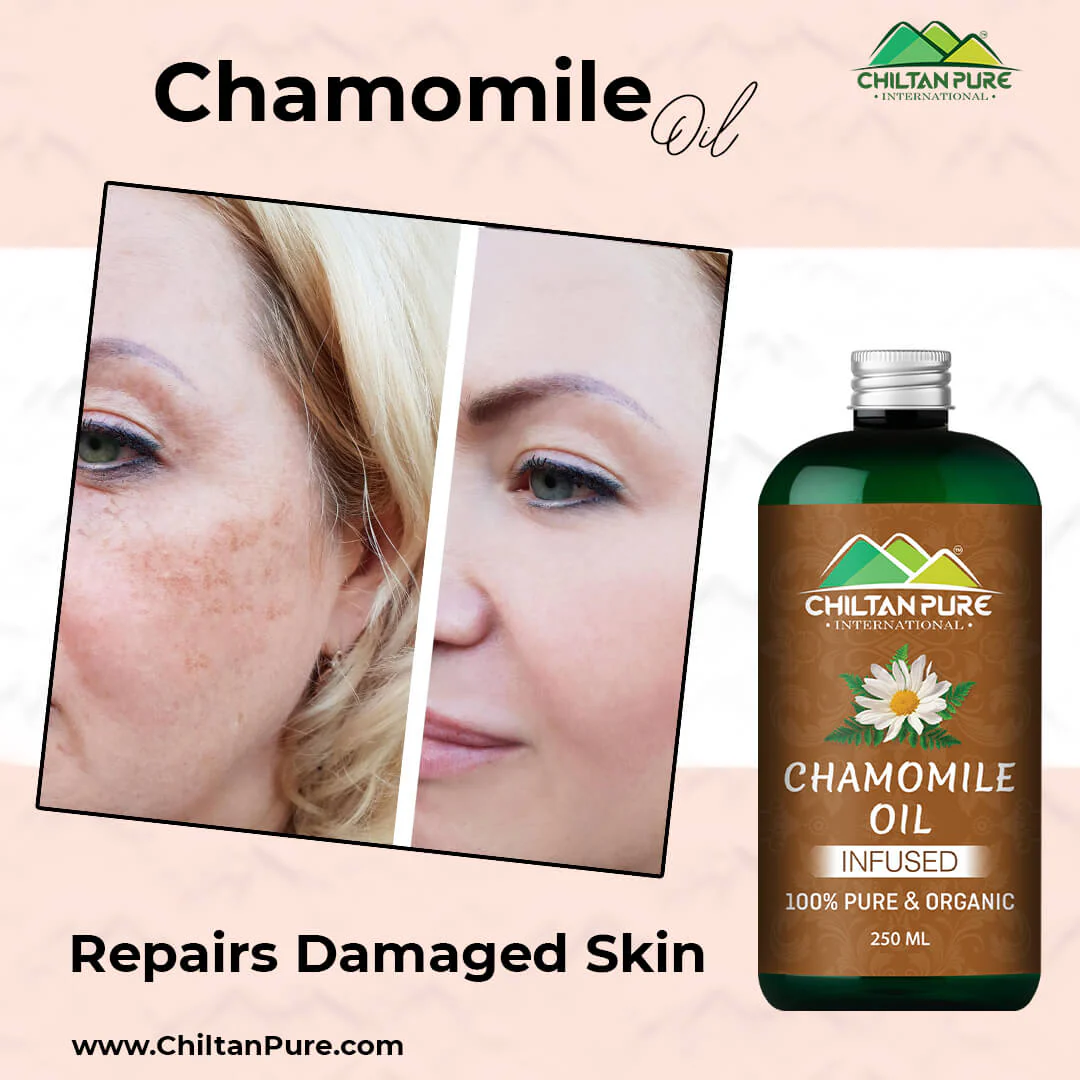 Chamomile Oil – Give Healthy Look to Your Face & Hair With This Majestic Liquid [بابونہ] 200ml - Image 3