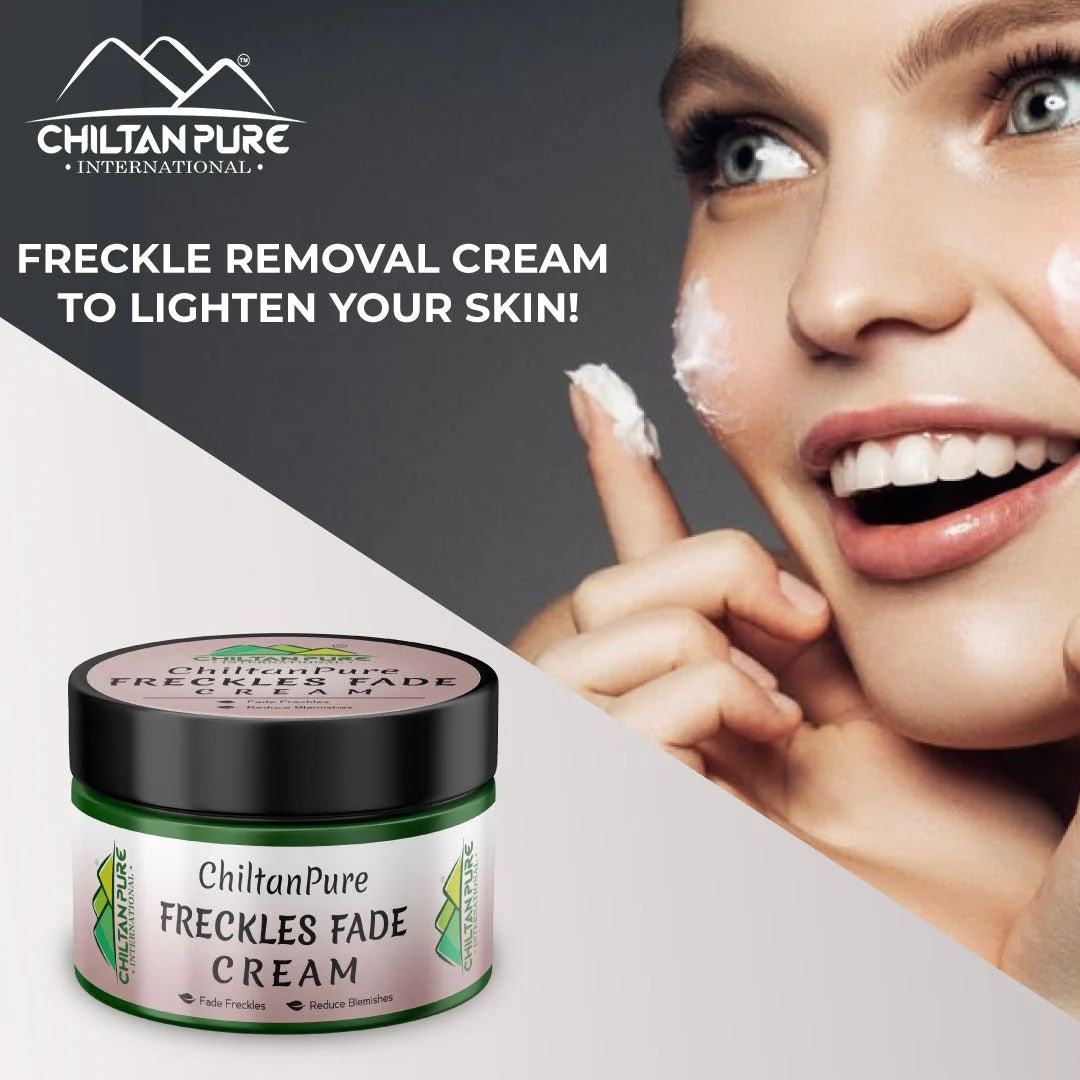 Freckles Fade Cream – Hydrates Skin, Fade Freckles, Reduce Blemishes & Lightens Hyperpigmentation - Image 3