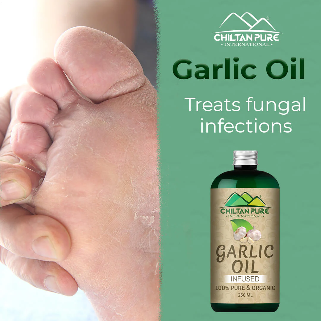 Garlic Oil – Prefect Addition to Your Daily Cooking & Healthy Routine [لہسن] 200ml - Image 3
