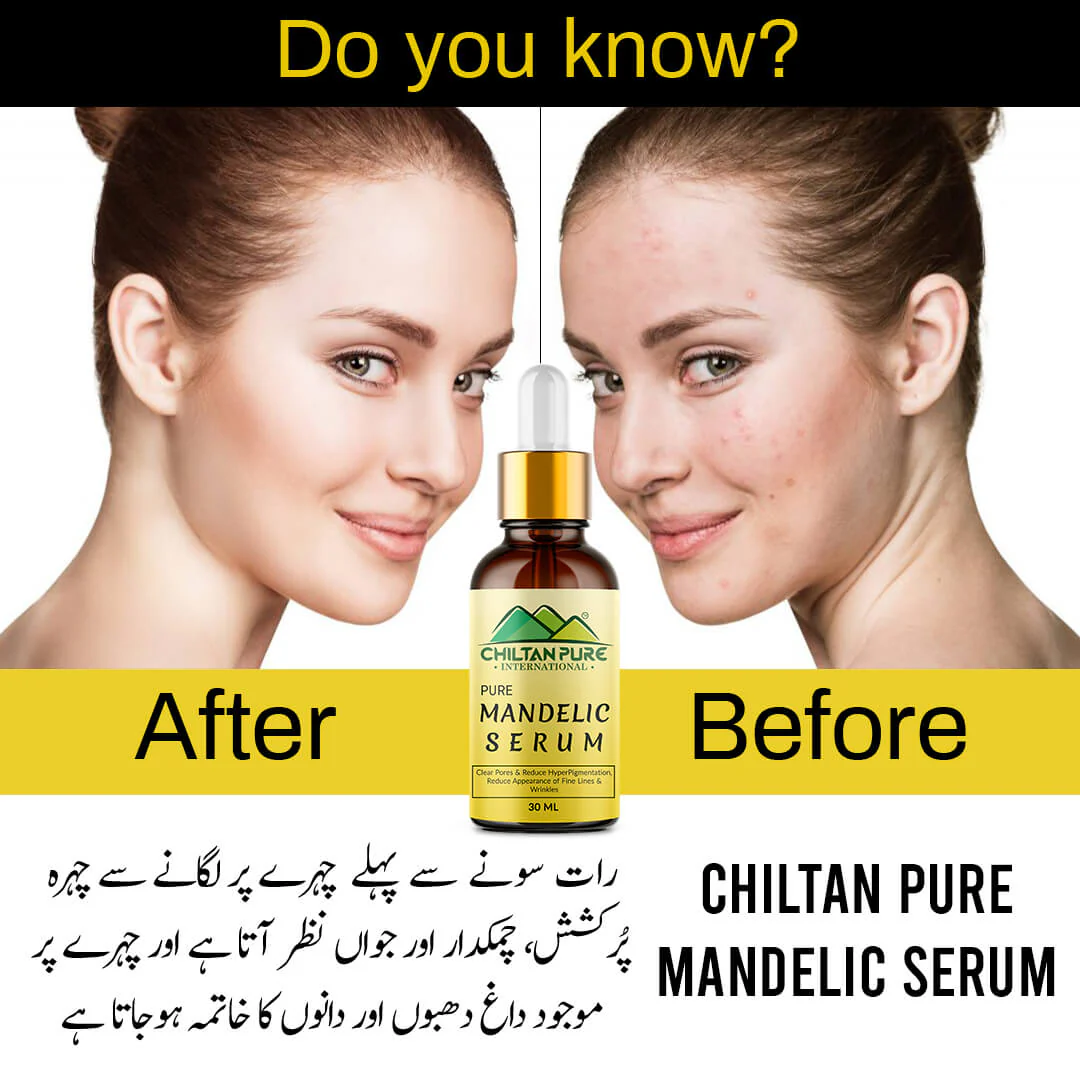 Mandelic Serum - Get Brighter & Luminous Complexion - Image 2