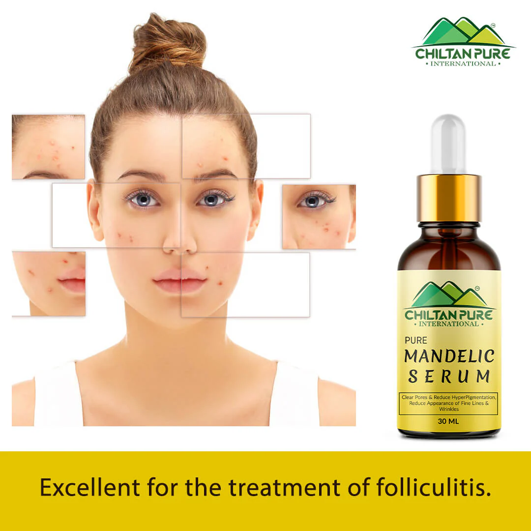 Mandelic Serum - Get Brighter & Luminous Complexion - Image 3