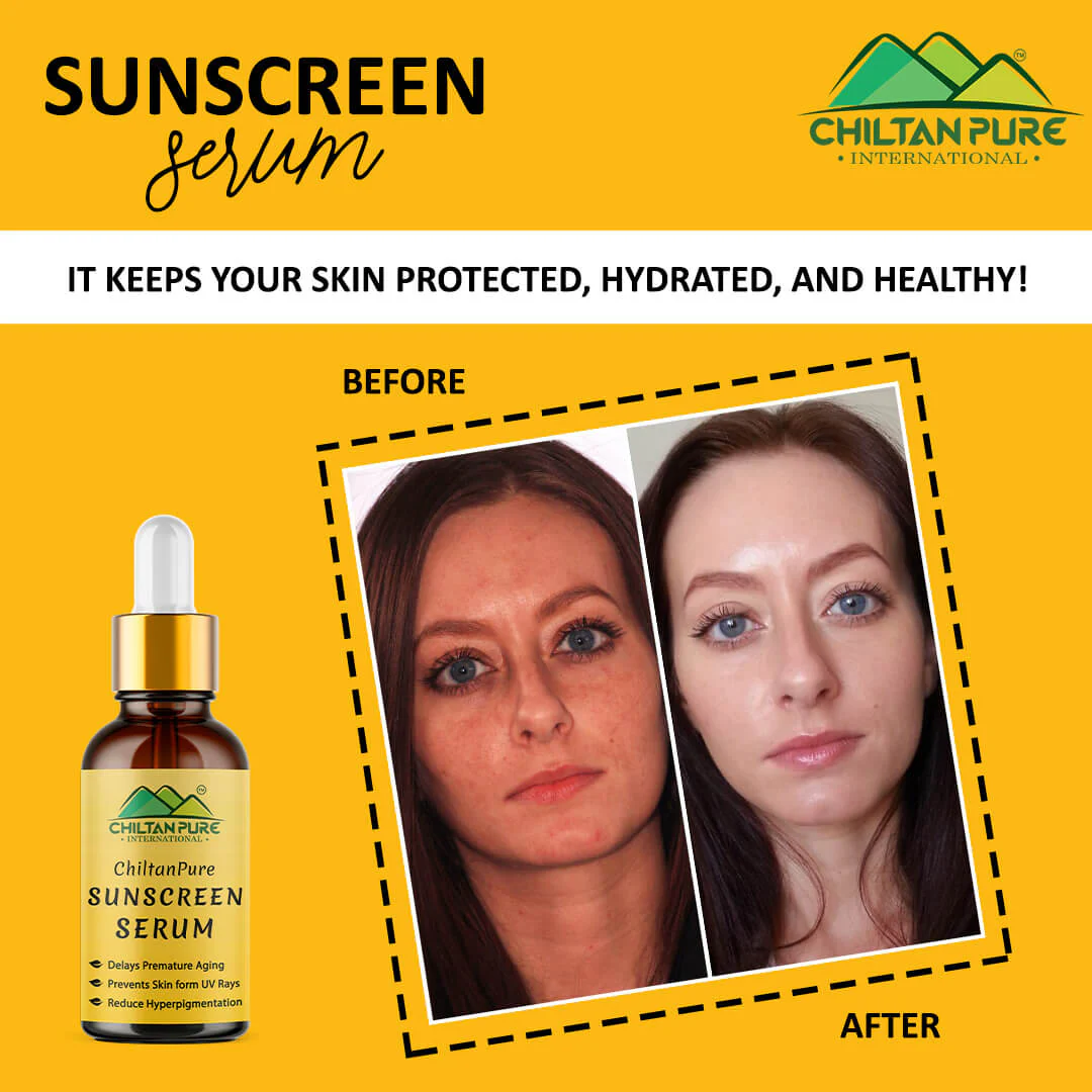 Sunscreen Serum – Delays Premature Aging, Prevents Skin from UV Rays, Reduce Hyperpigmentation & Risk of Skin Cancer 30ml - Image 5