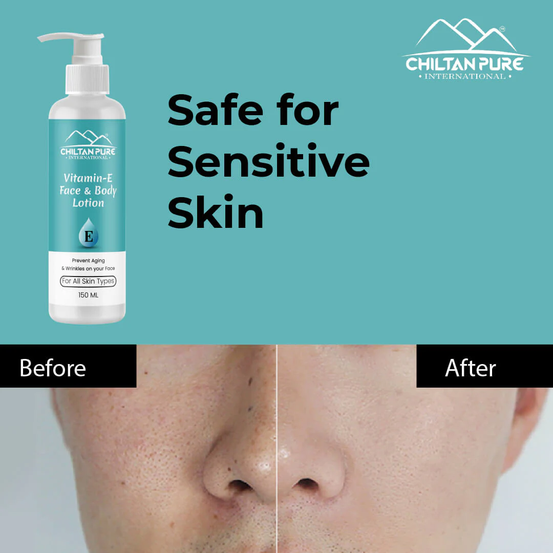 Vitamin-E Lotion - Used as a Moisturizer To Treat or Prevent Dry, Rough, Scaly, Itchy Skin Minor Skin Irritations (e.g., Diaper rash, Skin Burns From Radiation Therapy) - Image 3