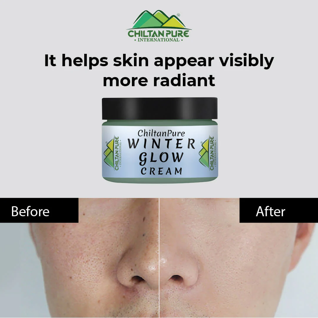 Winter Glow Cream – Formulated With Multivitamins & Moisturizers, Makes Skin Soft & Supple, Good For Dry & Dehydrated Skin - Image 3
