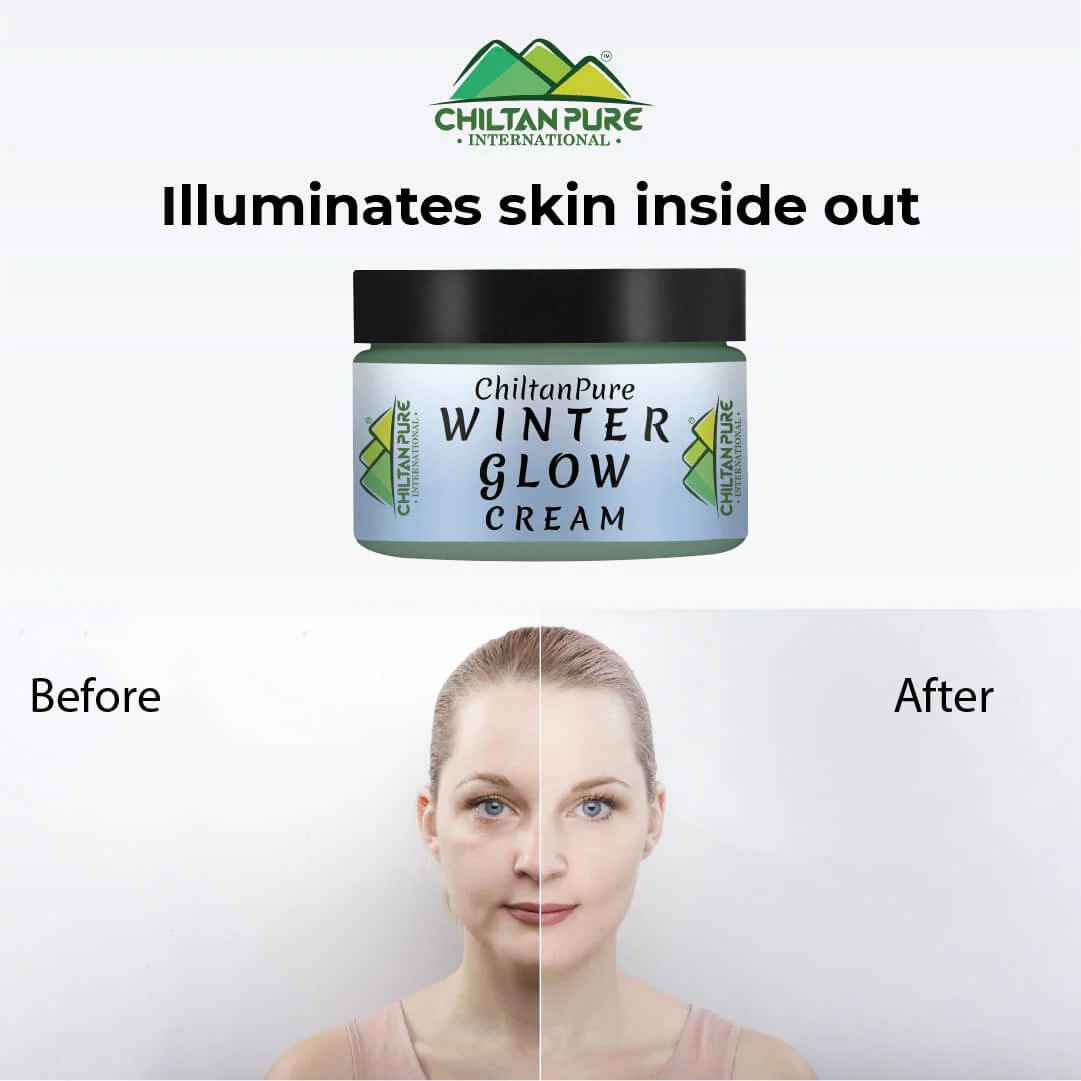 Winter Glow Cream – Formulated With Multivitamins & Moisturizers, Makes Skin Soft & Supple, Good For Dry & Dehydrated Skin - Image 4